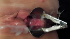 Speculum creampie